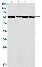 HNRNPM Antibody in Western Blot (WB)