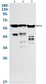 HNRNPK Antibody in Western Blot (WB)