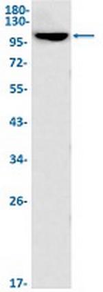 HLTF Antibody in Western Blot (WB)