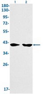 HLA-A Antibody in Western Blot (WB)