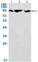HK1 Antibody in Western Blot (WB)