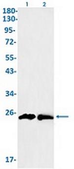 GSTP1 Recombinant Rabbit Monoclonal Antibody