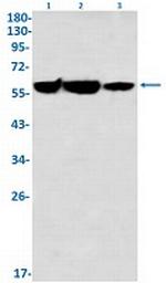 G6PD Recombinant Rabbit Monoclonal Antibody