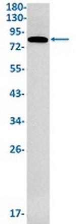 GFPT1 Recombinant Rabbit Monoclonal Antibody