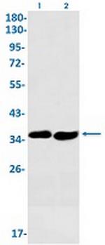 SMN1 Recombinant Rabbit Monoclonal Antibody