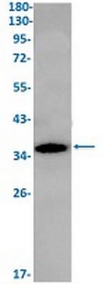 GDF15 Recombinant Rabbit Monoclonal Antibody