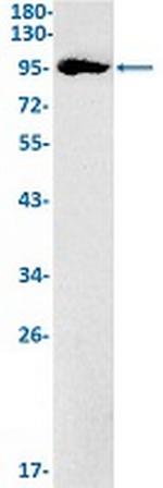 KAT2A Recombinant Rabbit Monoclonal Antibody
