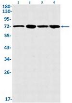 GCLC Recombinant Rabbit Monoclonal Antibody