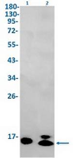 GABARAPL2 Recombinant Rabbit Monoclonal Antibody
