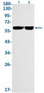 FTO Recombinant Rabbit Monoclonal Antibody
