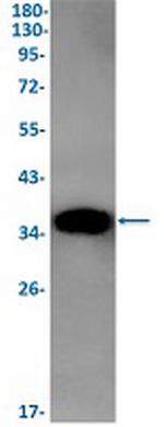 FBP1 Recombinant Rabbit Monoclonal Antibody