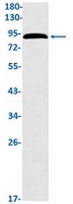 EPN1 Recombinant Rabbit Monoclonal Antibody