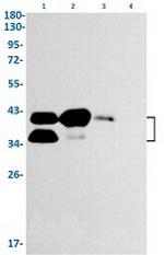 EPCAM Recombinant Rabbit Monoclonal Antibody