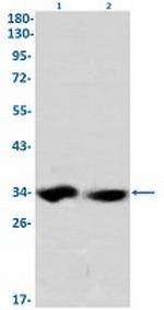 EMD Recombinant Rabbit Monoclonal Antibody