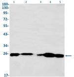 EIF4E Recombinant Rabbit Monoclonal Antibody