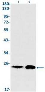 EIF4E Recombinant Rabbit Monoclonal Antibody