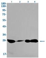 Phospho-EIF4E (Ser209) Recombinant Rabbit Monoclonal Antibody
