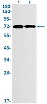 E2F1 Recombinant Rabbit Monoclonal Antibody