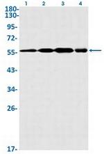 DKC1 Recombinant Rabbit Monoclonal Antibody