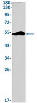DGAT1 Recombinant Rabbit Monoclonal Antibody