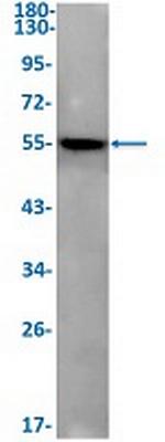 GSDME Recombinant Rabbit Monoclonal Antibody