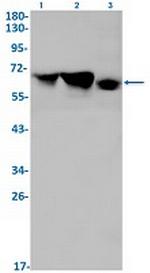 DDX5 Recombinant Rabbit Monoclonal Antibody