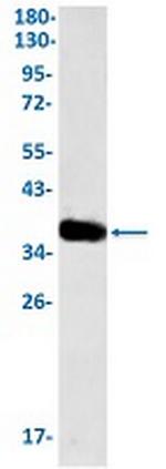 TNFRSF10D Antibody in Western Blot (WB)