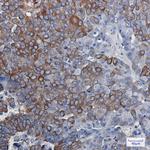 DCLK1 Antibody in Immunohistochemistry (Paraffin) (IHC (P))