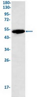 KRT7 Antibody in Western Blot (WB)