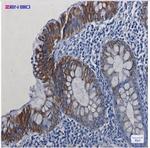 KRT19 Antibody in Immunohistochemistry (Paraffin) (IHC (P))