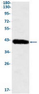 KRT19 Antibody in Western Blot (WB)