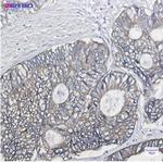 KRT19 Antibody in Immunohistochemistry (Paraffin) (IHC (P))