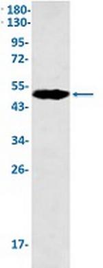 KRT18 Antibody in Western Blot (WB)