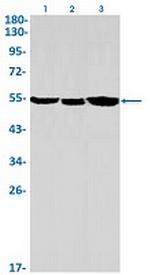 CYP17A1 Antibody in Western Blot (WB)