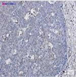 CYP1B1 Recombinant Rabbit Monoclonal Antibody