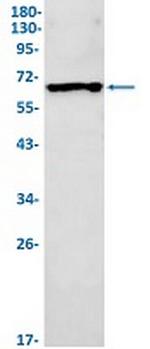 CYP1B1 Antibody in Western Blot (WB)