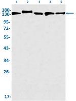 CYFIP1 Recombinant Rabbit Monoclonal Antibody