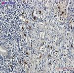 CCNE2 Recombinant Rabbit Monoclonal Antibody