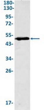 CCNE2 Antibody in Western Blot (WB)