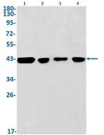 CXCR5 Recombinant Rabbit Monoclonal Antibody