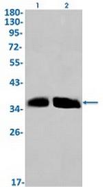 CCN2 Recombinant Rabbit Monoclonal Antibody