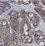 HSPE1 Antibody in Immunohistochemistry (Paraffin) (IHC (P))