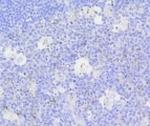 Active Caspase-3 Antibody in Immunohistochemistry (Paraffin) (IHC (P))