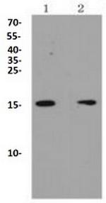 p16 ARC Recombinant Rabbit Monoclonal Antibody