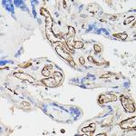 CD34 Recombinant Rabbit Monoclonal Antibody