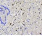 ABCG1 Recombinant Rabbit Monoclonal Antibody