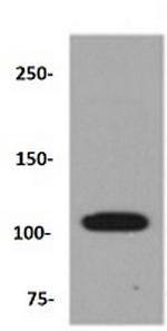 ABCG1 Antibody in Western Blot (WB)