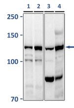 ATP-Citrate Lyase Antibody in Western Blot (WB)
