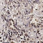 AKT Antibody in Immunohistochemistry (Paraffin) (IHC (P))