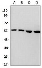 AKT Antibody in Western Blot (WB)